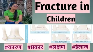 fracture in children || types | cause | treatment of fracture | pediatrics nursing in hindi lecture