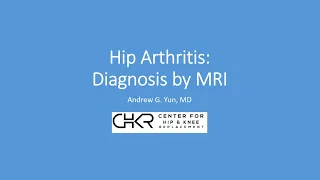 X-Ray vs MRI in the Diagnosis of Hip Arthritis