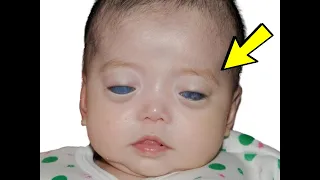 When her mother saw her eyes, she immediately abandoned her, the next day a miracle happened!