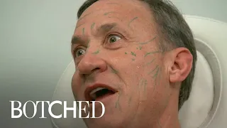 Dr. Terry Dubrow Freaks Out Paul With Face Filler Treatment | Botched | E!