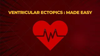 Ventricular Ectopics || ECG made Easy