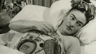 Frida Kahlo, 47, passed away wearing 28 different medical corsets to help her with this