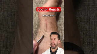 ER Doctor REACTS to "Satisfying" Hair Splinter Removal