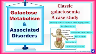 22: Galactose metabolism & Associated Disorders | carbohydrates Metabolism | Biochemistry