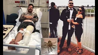 Fisherman miraculously survives bite from deadly blue-ringed octopus - Daily News