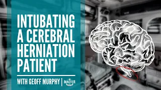 Intubating A Cerebral Herniation Patient | Mastering Airway Management