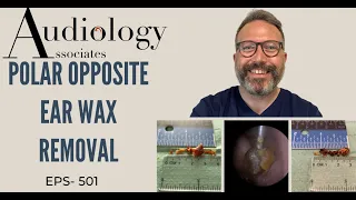 POLAR OPPOSITE EAR WAX REMOVALS - EP 501