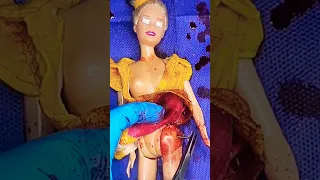 barbie Emergency Surgery 🏥😲