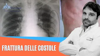 Frattura delle costole | Cosa Fare e come guarire in fretta