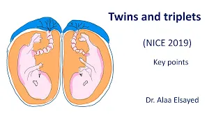 Twin pregnancy  - NICE 2019  - Key points