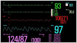 12min. EKG HEART BEAT SOUND for FIVEM ROLEPLAY