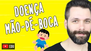 DOENÇA MÃO-PÉ-BOCA - Síndrome Mão Pé e Boca | Biologia com Samuel Cunha