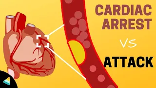 Cardiac Arrest vs Heart Attack: What makes them different?