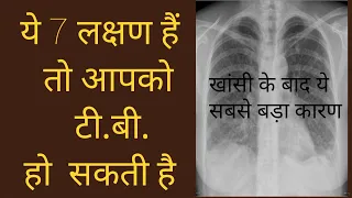 टी.बी के लक्षण और उपचार | Tuberculosis Symptoms Causes Prevention Treatments | T.B Symptoms In Hindi