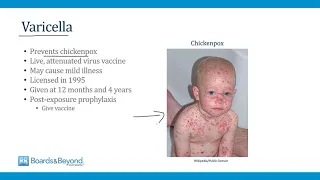 Pediatrics USMLE Step 2-3  — Vaccination — Boards and Beyond