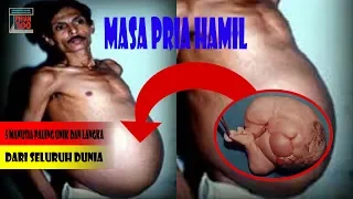 5 Manusia Paling Unik Dan Langka Dari Seluruh Dunia