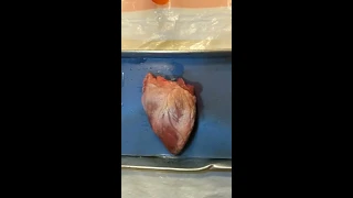 Sheep Heart Dissection Part 1: Identify external features