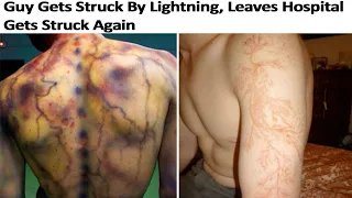 r/WellThatSucks | Struck By Lightning Twice In A Week