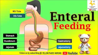 Enteral Feeding | Enteral Tube Feeding | ROUTES | NGT , NDT , NJT , OGT | Gastrostomy | Jejunostomy