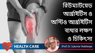 Rheumatoid Arthritis Symptoms || রিউম্যাটয়েড আর্থ্রাইটিস লক্ষণ || (Prof) Dr. Sukumar Mukherjee