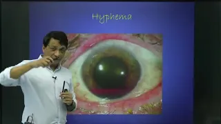 Opthalmology l Rapid Revision l Dr.Sashwat Ray l Prepladder l FMG l NMC