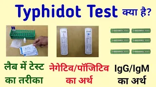 Typhidot test || Typhoid test || typhidot igm igg positive means in hindi