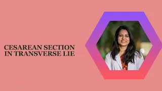 Difficult Cesarean section in transverse lie diagnosed as breech presentation | Dr Shilpa GB