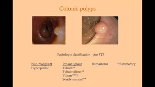 Colon Disorders and Surveillance - CRASH! Medical Review Series