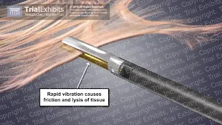 Harmonic Scalpel