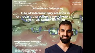 Use of intermaxillary elastics in orthodontic practice, easy, cheap and effective  Kleber Meireles