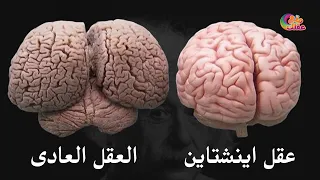 لماذا اينشتاين يمتلك ذكاء خارق ؟!