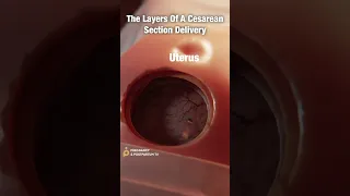 Layers of C-Section Delivery ✨FASCINATING✨ #shorts