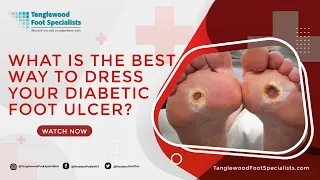 What is the Best Way to Dress Your Diabetic Foot Ulcer?