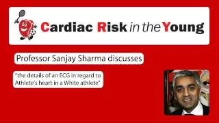 ECG 1: Athlete's heart in a White athlete