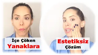 Get Plumper Cheeks without Botox | Reduce Sunken Cheek Appearance