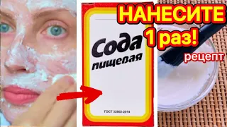 СИЛЬНЕЙШАЯ Маска с Содой ! Омолодила на 10 Лет Маска Для Лица от Морщин/ Рецепт