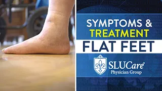 Flat Feet Symptoms, Causes & Treatment Options - SLUCare Orthopedic Surgery