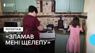 «Зламав мені щелепу»: у Полтаві за 5 років до притулку для жінок звернулося 400 жертв насильства