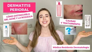 CÓMO ELIMINAR GRANOS ALREDEDOR DE LA BOCA | DERMATITIS PERIORAL ¿POR QUÉ SALE? DIFERENCIA CON ACNÉ