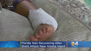 Florida Teen Recovering After Shark Attack Near Amelia Island