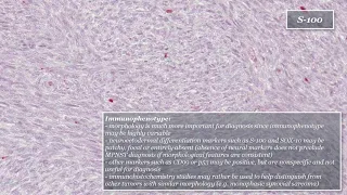 Malignant Peripheral Nerve Sheath Tumor (MPNST)