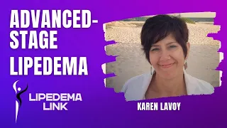 Living with Advanced Stage Lipedema - Karen's Journey to Diagnosis and Surgery