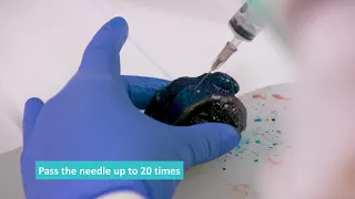 Fresh Tissue Sampling - Fine Needle Aspirate (FNA) Technique