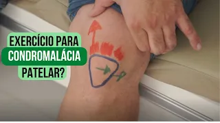 🦵 Exercício para condromalácia patelar