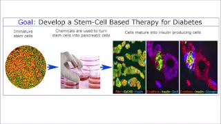 A Novel Stem Cell Approach for Curing Diabetes