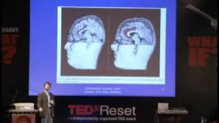 Ya Mutluysak da Bilmiyorsak?: Yankı Yazgan at TEDxReset 2011