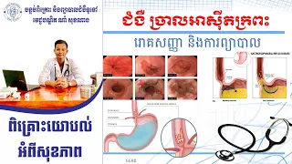 ជំងឺ ច្រាលទឹកអាស៊ីតក្រពះ #Reflux_Gastroesophageal.#Dr.Soknang Kh