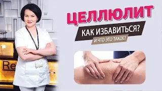 Целлюлит что это? Как избавиться от целлюлита? Борьба с целлюлитом на попе и ногах