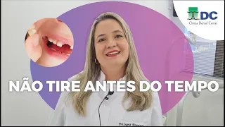 DENTE DE LEITE TEM RAIZ? | Dra. INGRID BITTENCOURT