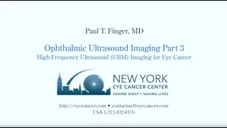 Ophthalmic Ultrasound Imaging Part III: High-Frequency Ultrasound (UBM) Imaging for Eye Cancer